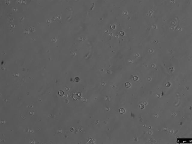 Яйцеклетки и сперматозоиды из стволовых клеток